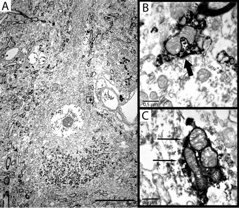 cells of betz|Perisomatic innervation and neurochemical features of giant .